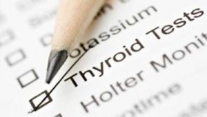 آزمایش تشخیص کم‌/پرکاری تیروئید