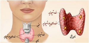 parathyroid