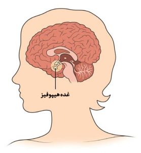 بالا بودن و افزایش پرولاکتین در زنان: علائم، عوارض و علت
